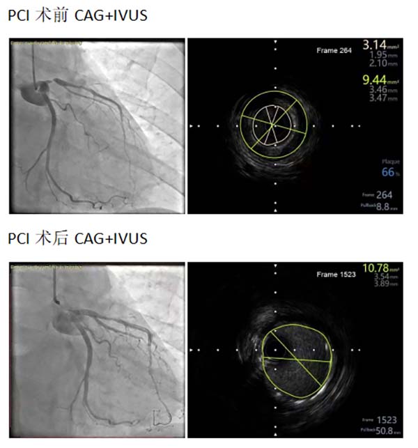 微信图片_20251030095225.jpg 微信图片_20251030095225.jpg
